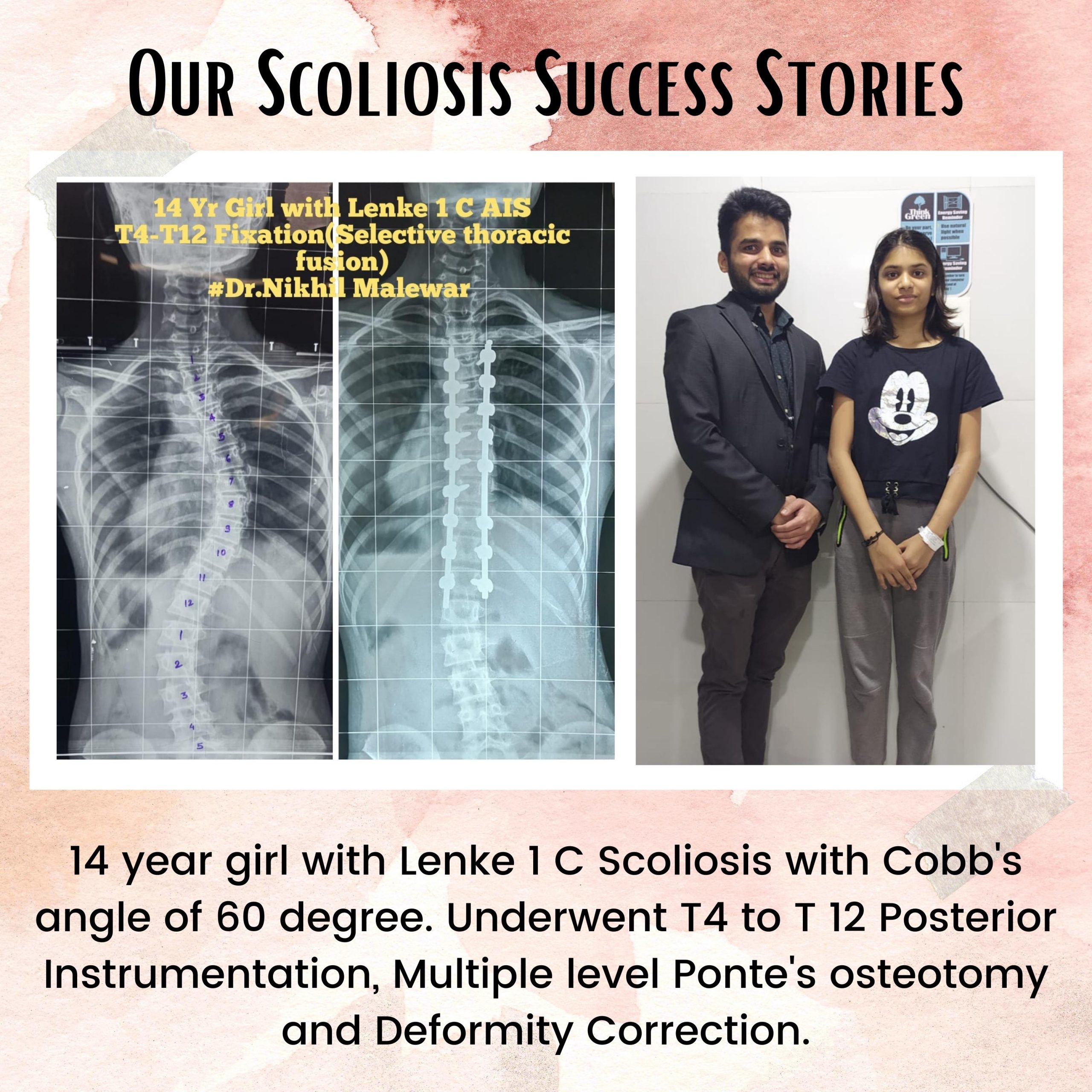 11 Our Scoliosis Success Stories