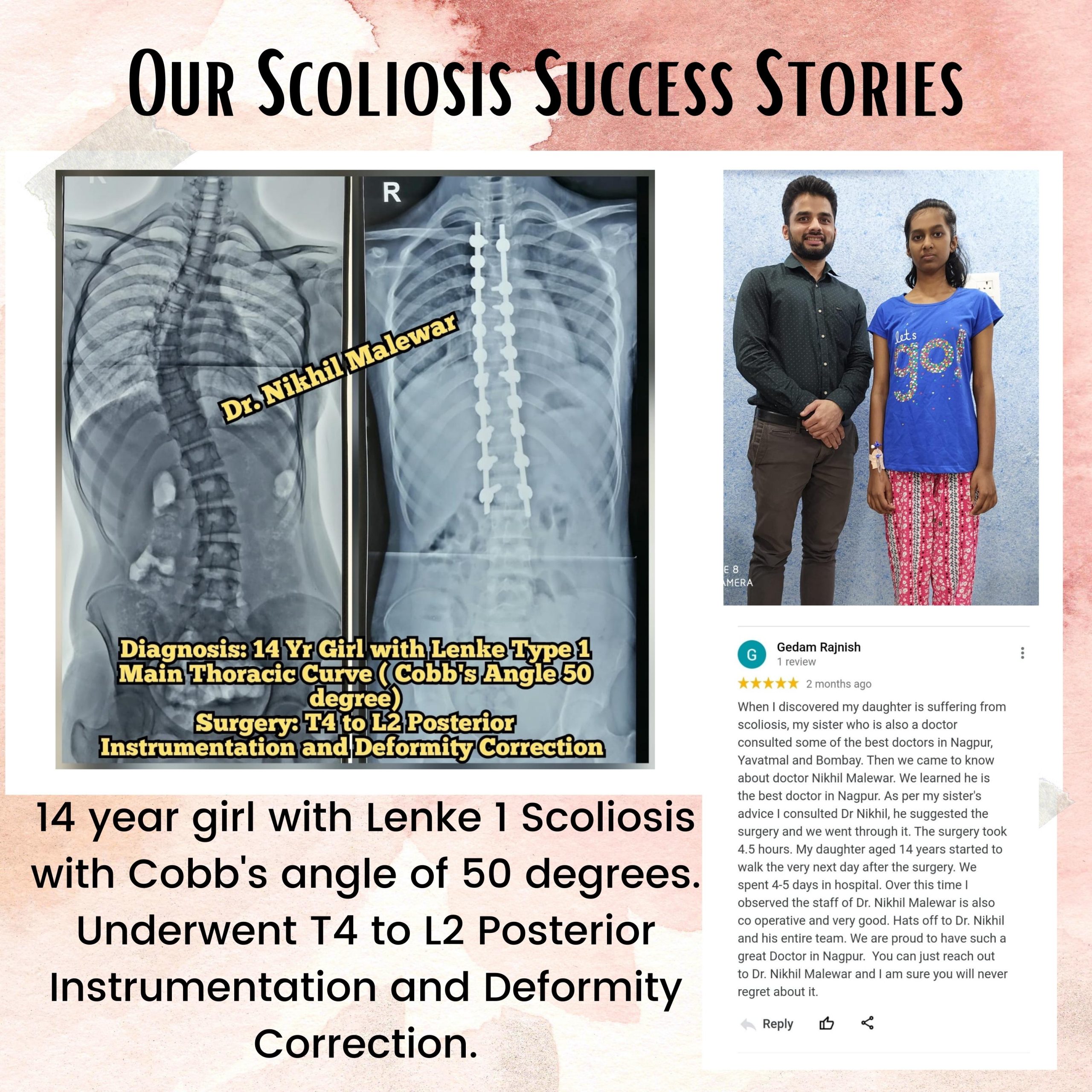 13 Our Scoliosis Success Stories