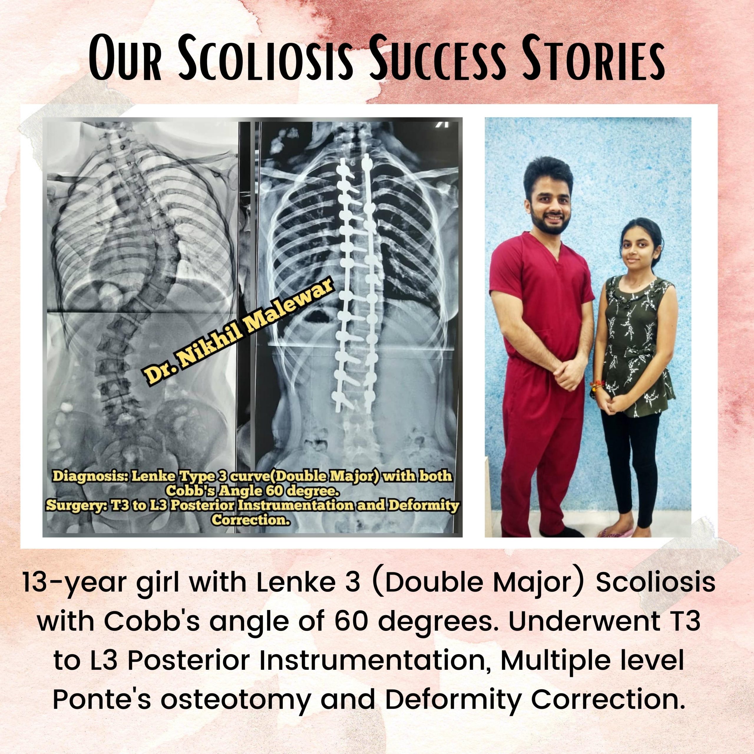 14 Our Scoliosis Success Stories