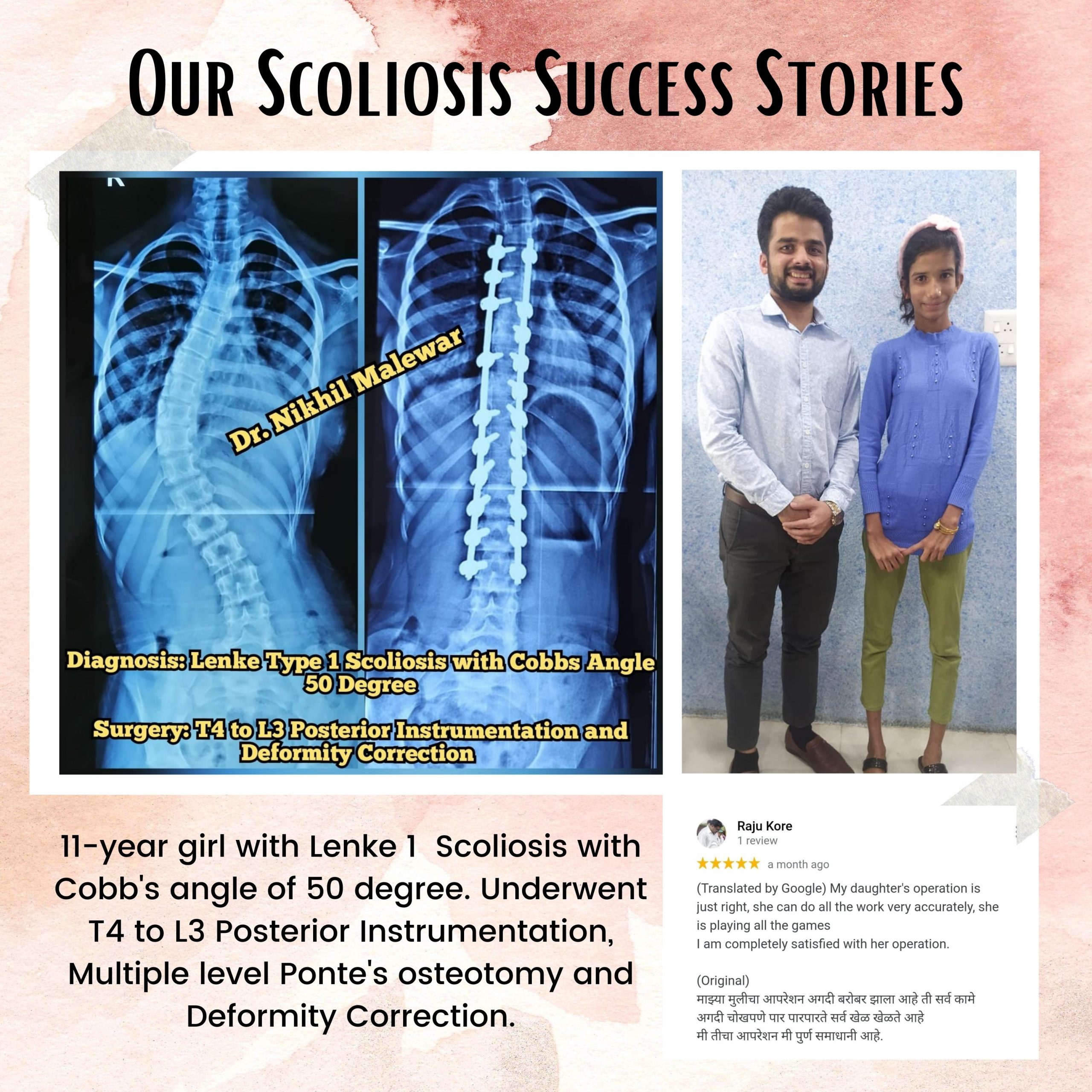 15 Our Scoliosis Success Stories