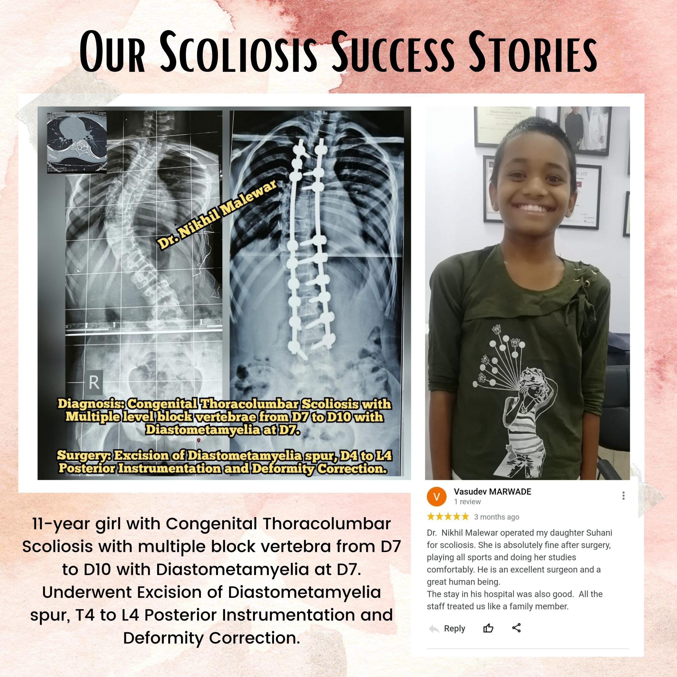 16 Our Scoliosis Success Stories