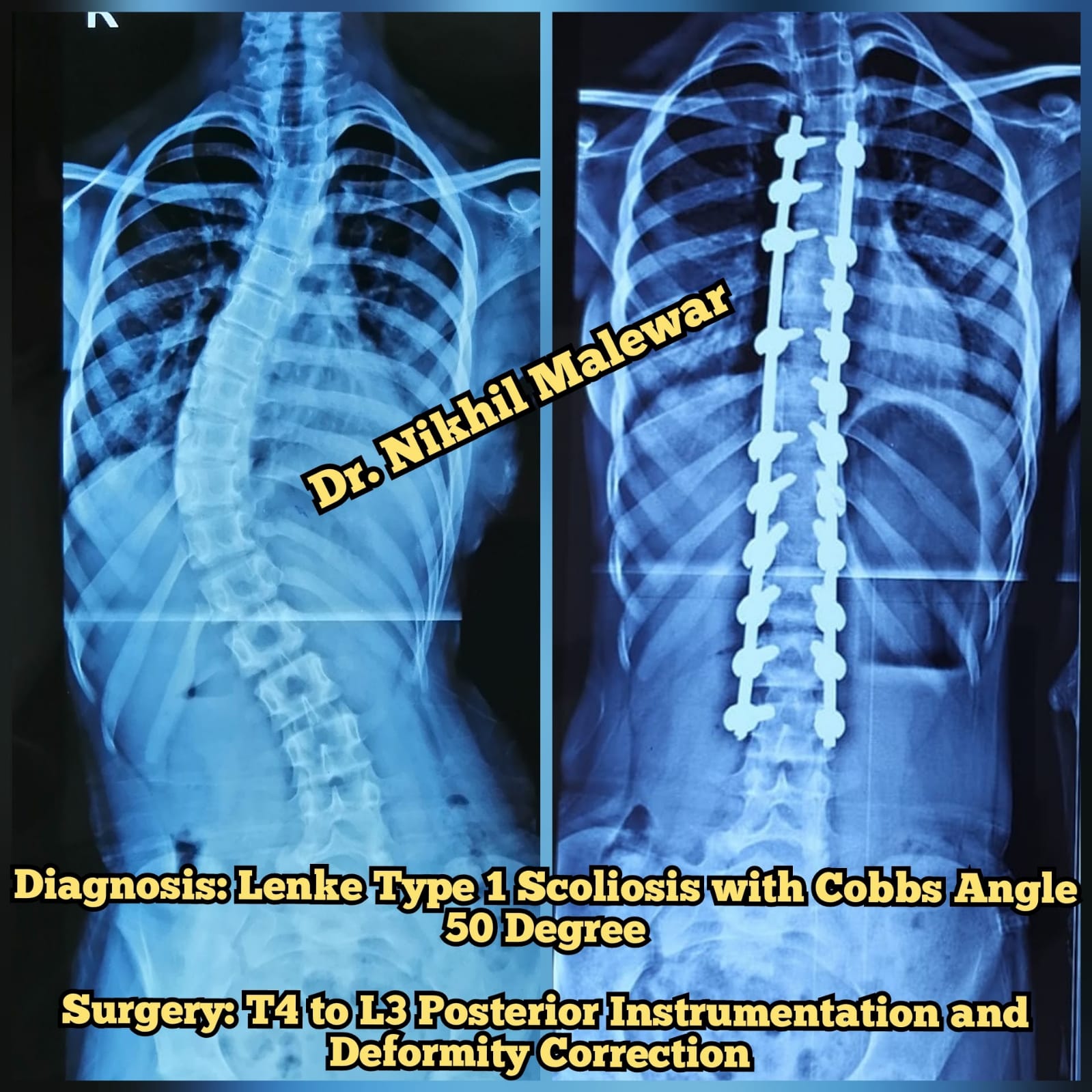 X rays (5)