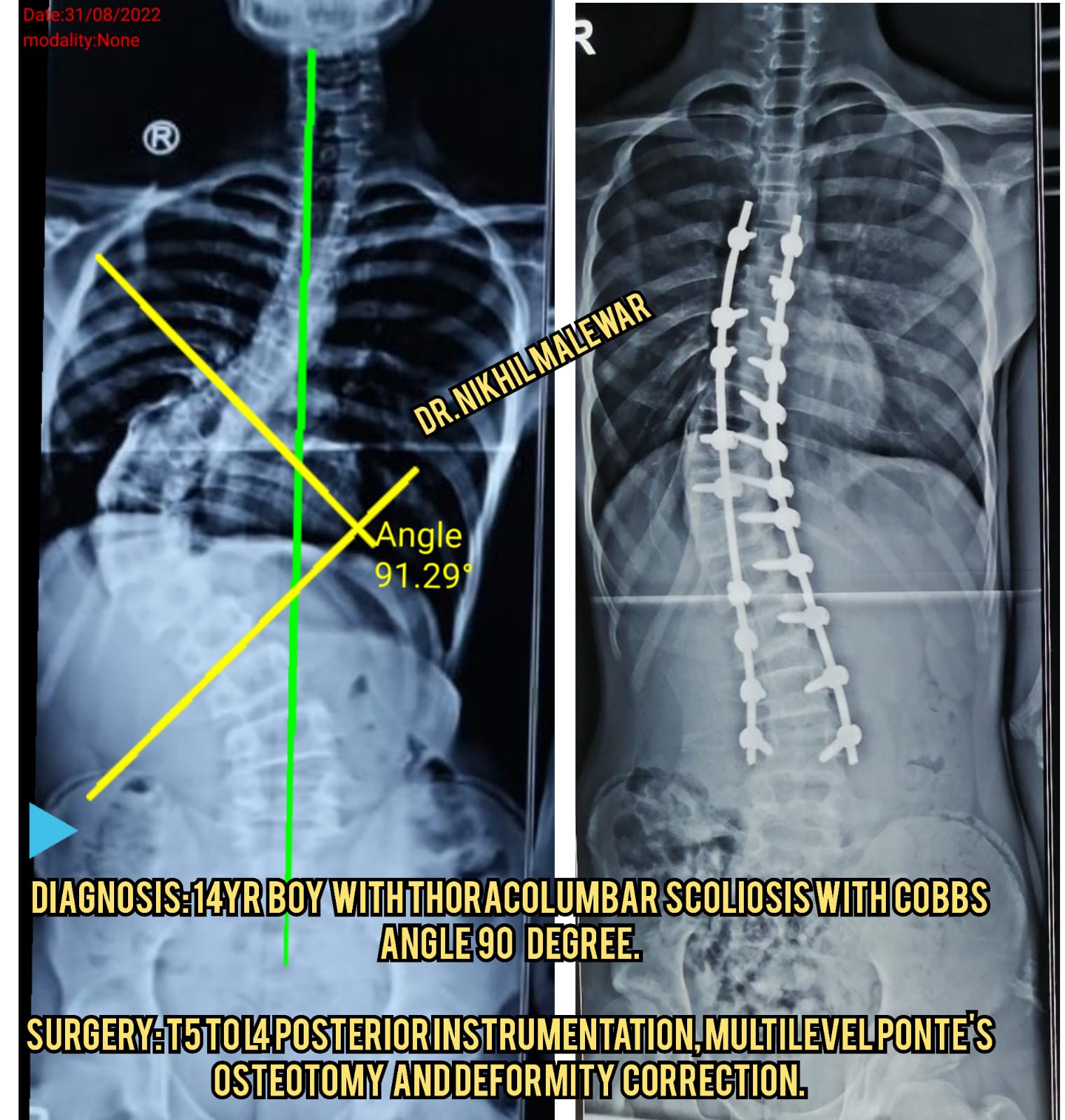 X rays (9)