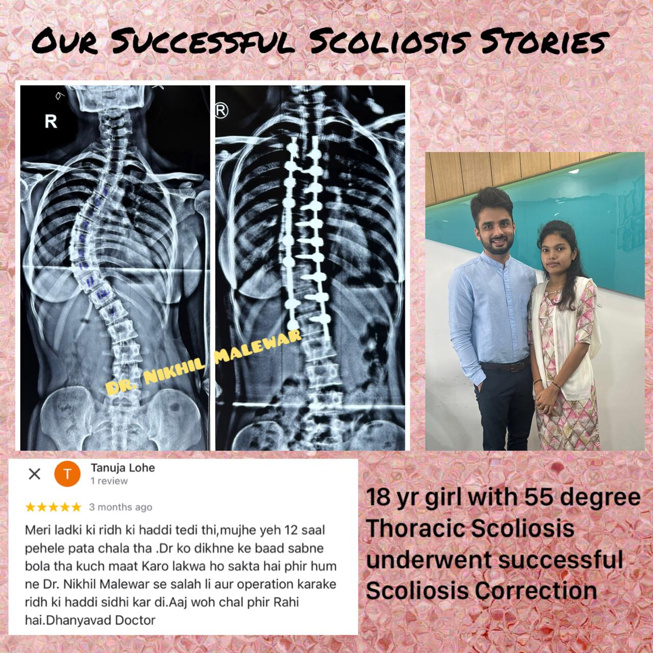 Our Scoliosis Success Stories (2)